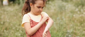 Little cute girl suffering from mosquito bites in the park Insektenstiche: Mädchen kratzt sich am Arm