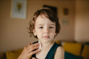 26-05-virus-del-varicella-rivista-svizzera-per-genitori-hg-stocksy Un bambino con la varicella