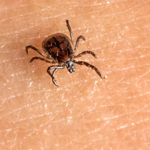 tutti i formati_visita_sanitaria_al_medico_tick Nessuna paura delle zecche